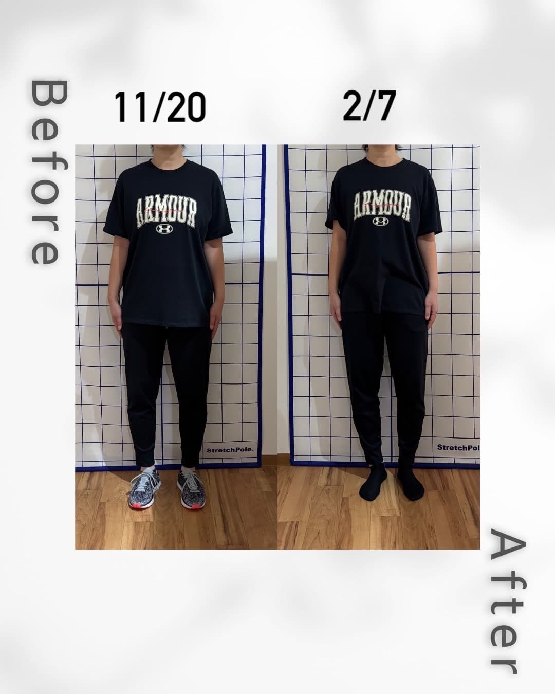 妻50代0さんのビフォーアフター(正面向き)