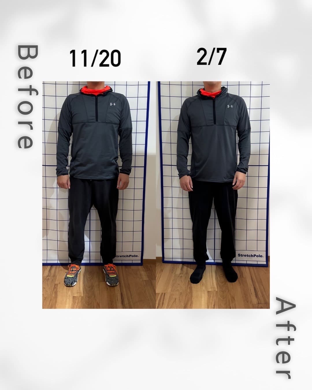 夫40代0さんのビフォーアフター(正面向き)